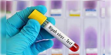 Read more about - Nipah Virus | নিপা ভাইরাস দমনে নয়া গাইডলাইন প্রকাশ করলো রাজ্য স্বাস্থ্য দপ্তর