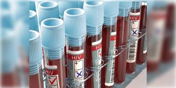 Read more about - HIV | গত ১৫ মাসে HIV পজিটিভ ৪৭৭ জন! তালিকায় রয়েছে ৮জন শিশুও! উদ্বেগ ছড়িয়েছে উত্তরাখণ্ডে!