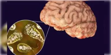 Read more about - করোনার পাশে মস্তিষ্ক খেকো অ্যামিবার প্রকোপে উদগ্রীব আমেরিকা, জারি হয়েছে সতর্কতা 