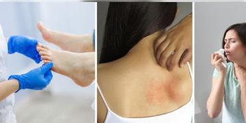 Read more about - Monsoon Skin Problem | বৃষ্টিতে ভেজার পর সতর্কতা না মানলেই হতে পারে চুলকানি, ফাঙ্গাল ইনফেকশন! জানুন বৃষ্টির দিনে কীভাবে ত্বকের সমস্যা এড়াবেন!