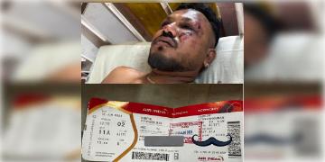 Read more about - Ahmedabad Plane Crash | 'টেক-অফের ৩০ সেকেন্ড পরেই প্রবল জোরালো শব্দ হল।' -অভিশপ্ত বিমান থেকে রক্ষা পেয়ে কী বললেন রমেশ?