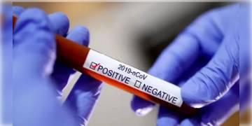 Read more about - বাংলার কোভিড গ্রাফ আবার ঊর্ধ্বমুখী! উত্তরবঙ্গের দুই জেলায়  উদ্বেগ বাড়ছে।  