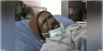 Read more about - অটোপ্সি টেবিলে হঠাৎ জেগে উঠল ‘মৃতদেহ’! তীব্র সমালোচনার মুখে  হাসপাতালের চিকিৎসকরা।  