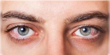 Read more about - কোভিড ১৯: করোনার টার্গেট চোখ, ভয়ানক ক্ষতির মুখে দৃষ্টিশক্তি!