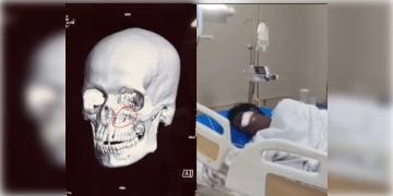 Read more about - Khagen Murmu | খগেন মুর্মু হামলা কান্ডে রাজ্যের কাছে রিপোর্ট তলব! দ্রুত না দিলে নেওয়া হবে আইনি পদক্ষেপ!