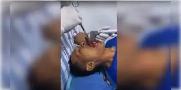 Read more about - নেটিদুনিয়ার চক্ষু চড়ক  গাছ! ২৪ বছরের যুবকের গলা থেকে চিকিৎসকেরা বের করছেন ৭ ইঞ্চি লম্বা মাছ 