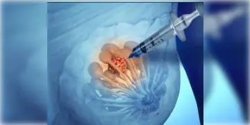 Read more about - জ্ঞানত স্তন ক্যানসারের অস্ত্রোপচার করে নয়া নজির রামপুরহাট হাসপাতালের