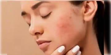 Read more about - শীত মানেই শুষ্ক ত্বক, ক্রিম ব্যবহার করেও তেমন লাভ হচ্ছেনা? এবার কি করবেন চলুন জেনে নেওয়া যাক 