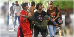 Read more about - Bangladesh Student Protest | বাংলাদেশে বৈষম্যবিরোধী ছাত্র আন্দোলনে নষ্ট হয়েছে প্রায় ৪০১ জনের চোখ