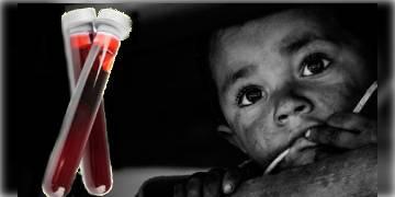 Read more about - ন্যাশানাল ফ্যামিলি হেলথ সার্ভের পরিসংখ্যান অনুযায়ী, রক্তাল্পতায় ভুগছে ভারতের অধিকাংশ শিশু ও মহিলা। 