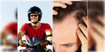 Read more about - Hair Fall Control Oil | রোজ হেলমেট পড়ার কারণে মাথায় পড়েছে টাক? জানুন কীভাবে গজাবেন নতুন চুল!