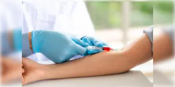 Read more about - Essential Blood Test | রোগের উপসর্গ দেখা না দিলেও, আগের থেকেই সতর্ক থাকতে প্রতি বছর এই রক্ত পরীক্ষাগুলি করানো ভালো!