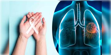 Read more about - World Lung Cancer Day | দীর্ঘস্থায়ী কাশি, বুকে ব্যথা? হতে পারে ফুসফুসের ক্যান্সার!