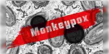 Read more about - রূপ পরিবর্তন করে মাঙ্কি পক্স দ্রুত ছড়িয়ে পড়ছে! বিশ্ব স্বাস্থ্য সংস্থার বিশেষজ্ঞরা এবিষয়ে কী বলছেন জানুন