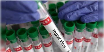 Read more about - Monkeypox Clade 1 | ভারতে প্রথমবার মাঙ্কিপক্সের ক্লাড ১ স্ট্রেনে আক্রান্তের খোঁজ, আগেই সতর্ক করেছিল WHO