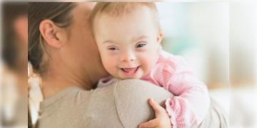 Read more about - Treatment of Down syndrome | ডায়মন্ড হারবার মেডিকেল কলেজে মিলবে ডাউন সিনড্রোমের চিকিৎসা