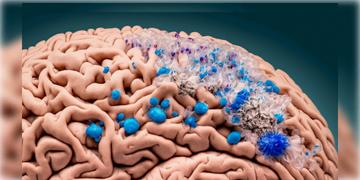 Read more about - Microplastic | মানুষের মস্তিষ্কেও 'প্লাস্টিক দূষণ'! বিশ্বব্যাপী জরুরি পদক্ষেপ নেওয়ার আহ্বান গবেষকরদের