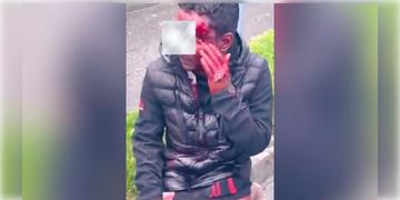 Read more about - Dublin | বিদেশে বর্ণবিদ্বেষের শিকার ভারতীয়! মিথ্যা অপবাদ দিয়ে মারধর করে প্যান্ট খুলে নেয় হামলাকারীরা!