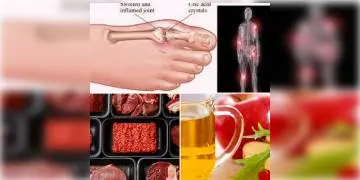 Read more about - আপনার কি ইউরিক অ্যাসিড আছে ? তাহলে জেনে নেওয়া যাক কি খাবেন র কি খাবেন না !