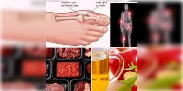 Read more about - আপনার কি ইউরিক অ্যাসিড আছে ? তাহলে জেনে নেওয়া যাক কি খাবেন র কি খাবেন না !