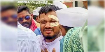 Read more about - Ahmedabad Plane Crash | ট্রমা কাটেনি এখনও! কারোর সাথে কথা বলছেননা একমাত্র জীবিত যাত্রী বিশ্বাস কুমার রমেশ