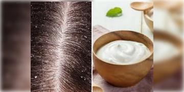 Read more about - Hair Mask for Dandruff | খুশকি কি ছোঁয়াচে? কীভাবেই বা তৈরী হয় খুশকি? জানুন খুশকি সম্পর্কে এবং কীভাবে বানাবেন খুশকির জন্য হেয়ার মাস্ক!