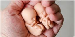 Read more about - Women Abortion Rights: সকল নারী নিরাপদ ও আইনগত গর্ভপাতের অধিকারী