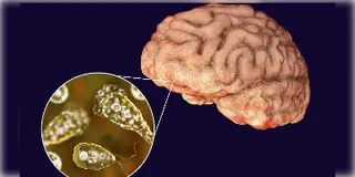 Read more about - Brain Eating Amoeba | মস্তিষ্ক কুড়ে কুড়ে খাচ্ছে এক ভয়ঙ্কর অ্যামিবা! কেরলে মৃত ১৯, আক্রান্ত ৬১জন