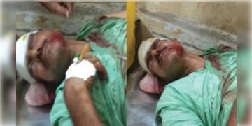 Read more about - ষষ্ট দফার ভোটে সকালে বীজপুরের কাউন্সিলরকে বেধড়ক মারধর, ভর্তি হাসপাতালে