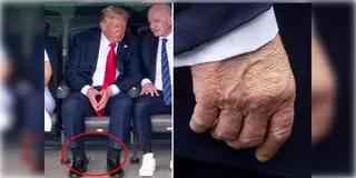 Read more about - Donald Trump | পৌঁছচ্ছে না পর্যাপ্ত রক্ত, জটিল রোগে আক্রান্ত  মার্কিন প্রেসিডেন্ট ডোনাল্ড ট্রাম্প!