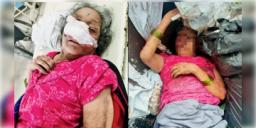 Read more about - Mumbai | ক্যান্সার আক্রান্ত বৃদ্ধাকে আবর্জনার স্তূপে ফেলে গেলো নাতি! নিষ্ঠুর ঘটনা মুম্বইয়ে!