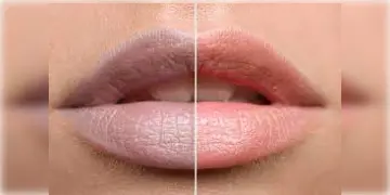 Read more about - Lips Care | ঠোঁটের কালোভাব দূর করুন নিমেষের মধ্যে! ঘরোয়া পদ্ধতিতে আপনার ঠোঁট করুন গোলাপী ও মসৃণ!