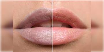 Read more about - Lips Care | ঠোঁটের কালোভাব দূর করুন নিমেষের মধ্যে! ঘরোয়া পদ্ধতিতে আপনার ঠোঁট করুন গোলাপী ও মসৃণ!