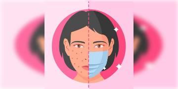 Read more about - "মাস্কনে" -এর সমস্যা থেকে কিভাবে রাখবেন নিজের ত্বককে সুরক্ষিত, আসুন জেনে নেওয়া যাক তারই কিছু টিপস! 