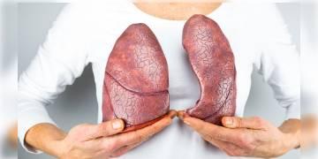 Read more about - আপনি কি জানেন ধূমপান না করলেও হতে পারে ফুসফুসের ক্যানসার?