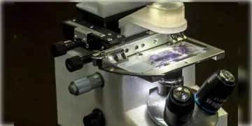 Read more about - Govt Hospital | চিকিৎসা ব্যবস্থা উন্নত করতে রাজ্যের ২ সরকারি হাসপাতালে এলো অত্যাধুনিক ২ কোটি টাকার মাইক্রোস্কোপ যন্ত্র