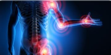 Read more about - Arthritis Reason and Type | জয়েন্টের সমস্যায় ভুক্তভুগী ছোটরাও, কেন কী প্রকার আর্থরাইটিসে জানুন!