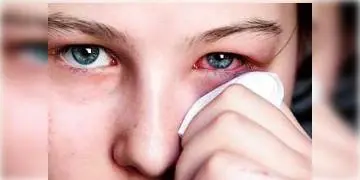 Read more about - একজনের থেকে অন্যজনের হতে পারে কনজাংটিভাইটিস 