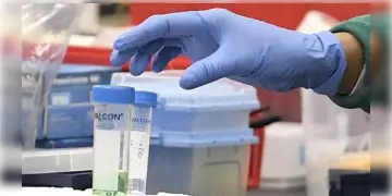 Read more about - Guillain Barre Syndrome । গুলেন ব্যারি সিনড্রোমে পুনেতে আক্রান্ত অন্তত ১১১জন! কতটা আতঙ্কের পরিস্থিতি পশ্চিমবঙ্গে?