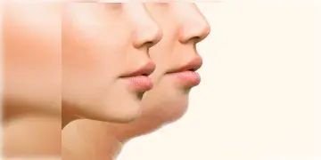 Read more about - Face Yoga | মুখের মেদ, ডাবল চিন দূর করার সঙ্গে সঙ্গে ত্বকের সমস্যা দূর করে উজ্জ্বলতা বাড়াবে এই যোগা ও মুদ্রাসনগুলি!