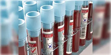 Read more about - HIV | গত ১৫ মাসে HIV পজিটিভ ৪৭৭ জন! তালিকায় রয়েছে ৮জন শিশুও! উদ্বেগ ছড়িয়েছে উত্তরাখণ্ডে!