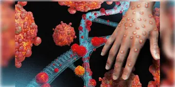 Read more about - Monkeypox | এই নিয়ে দুবছরে দুবার! মাঙ্কি পক্সকে বিশ্বব্যাপী স্বাস্থ্য জরুরী অবস্থা ঘোষণা বিশ্ব স্বাস্থ্য সংস্থার