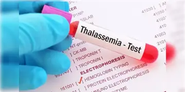 Read more about - Thalassemia in Bangladesh ।  বাংলাদেশের ১১.৪ শতাংশ মানুষ থ্যালাসেমিয়ার বাহক! হেপাটাইটিস-বি-পজিটিভের বাহক ১.২শতাংশ!