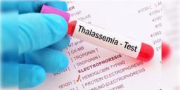 Read more about - Thalassemia in Bangladesh । বাংলাদেশের ১১.৪ শতাংশ মানুষ থ্যালাসেমিয়ার বাহক! হেপাটাইটিস-বি-পজিটিভের বাহক ১.২শতাংশ!