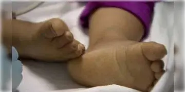 Read more about - আয়ুর্বেদিকে ভুল চিকিৎসায় ৩ বছরের শিশুর মৃত্যু, জেরায় আত্মসমর্পণ করেছে ভুয়ো ডাক্তার