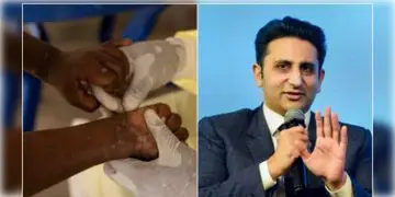 Read more about - Mpox Vaccine । মাঙ্কিপক্সের জন্য ভ্যাকসিন তৈরী করছে সিরাম ইনস্টিটিউট অফ ইন্ডিয়া