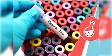 Read more about - Malaria Test | ম্যালেরিয়া শনাক্ত করতে লাগবে না রক্তপরীক্ষা! আবিষ্কার হলো 'বিকল্প' লেজ়ার ও আলট্রাসাউন্ড প্রযুক্তির মিশ্র পদ্ধতি