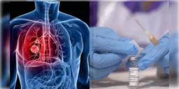 Read more about - Lung Cancer Vaccine । হাজার হাজার মানুষের জীবন বাঁচানোর 'আশা', শুরু হলো বিশ্বের প্রথম ফুসফুস ক্যানসারের টিকার ট্রায়াল