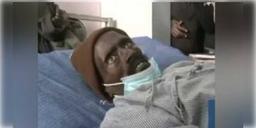 Read more about - অটোপ্সি টেবিলে হঠাৎ জেগে উঠল ‘মৃতদেহ’! তীব্র সমালোচনার মুখে হাসপাতালের চিকিৎসকরা।