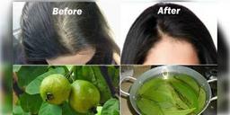Read more about - পেয়ারা পাতার জাদুতেই মিটবে চুল পড়ার সমস্যা, কীভাবে জানেন?